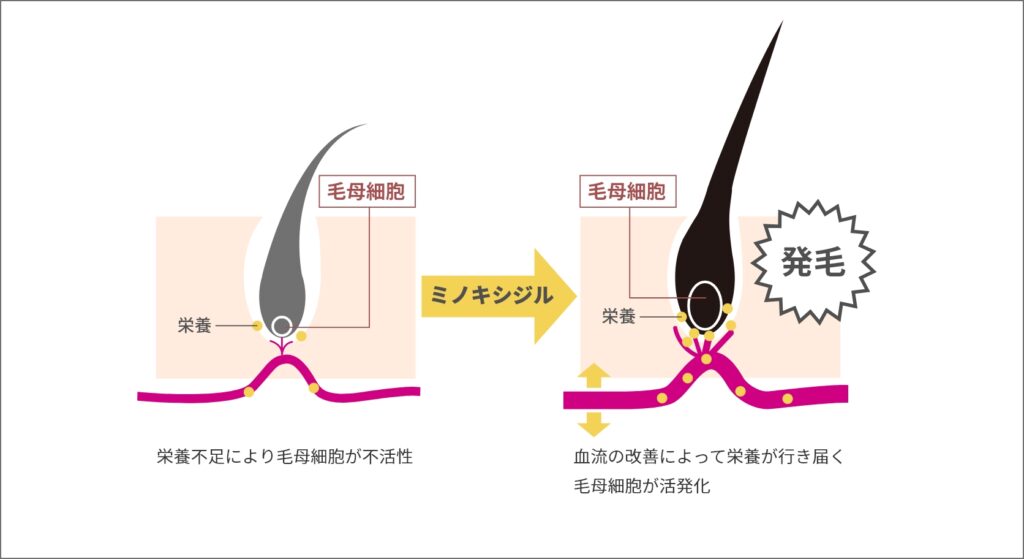 Mechanism-of-minoxidil